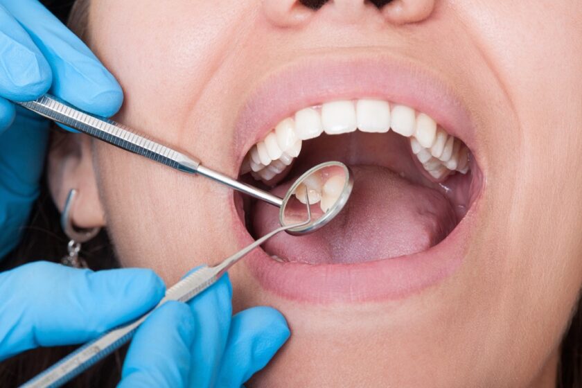 How to Maintain Optimal Oral Health