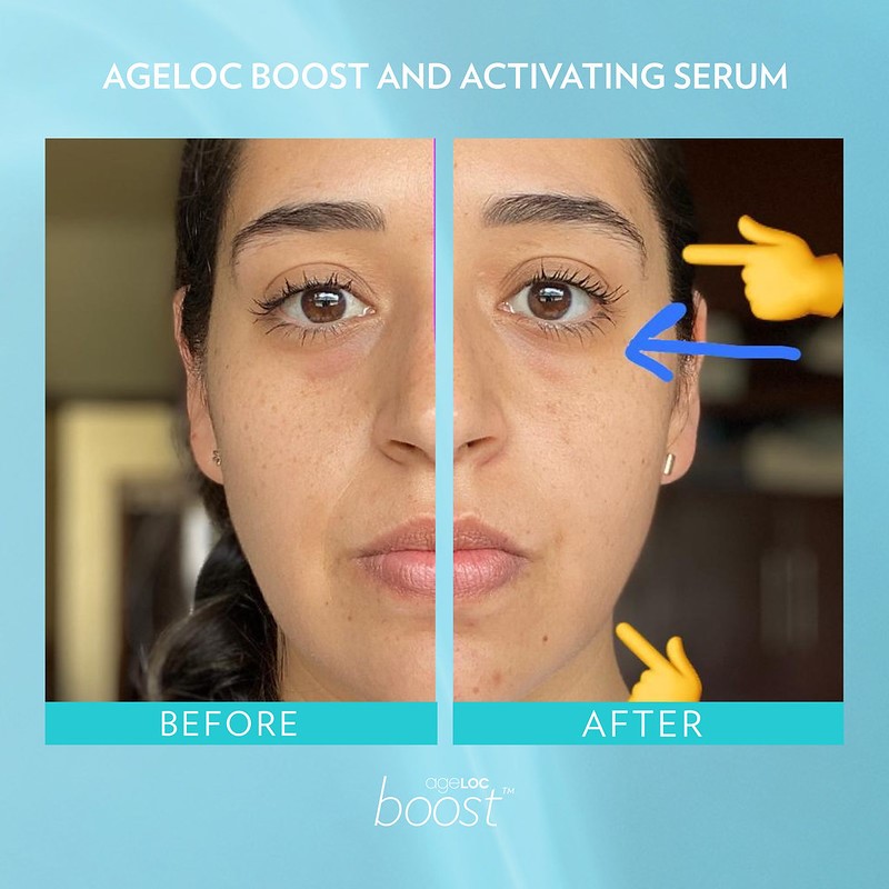 Get The Glow You've Always Wanted With ageLOC Boost